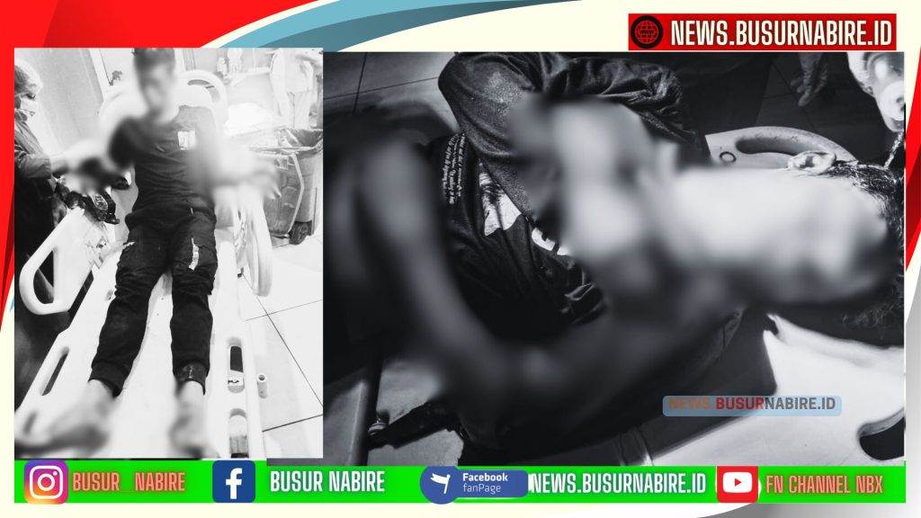 Dibacok Saat Tidur, Dua Warga Nabire Nyaris Tewas! Kapolres: Pelaku Masih Diburu! (Foto: Istimewa)