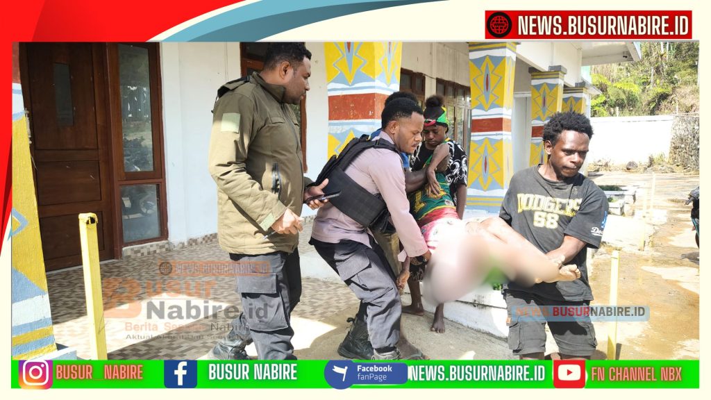 Kecelakaan Tunggal di Jalan Trans Nabire–Dogiyai, 7 Korban Luka, Dua Anak Kritis (Foto: Humas Polres Dogiyai)
