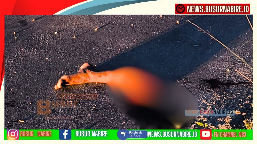 Tragis! Pelajar 15 Tahun di Nabire Kehilangan Kaki Usai Tabrak Trotoar Saat Mabuk (Foto: Humas Polres Nabire)