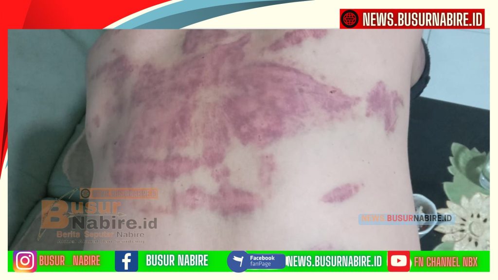 Ketua Partai Garuda Kota Jayapura Usman Tempuh Jalur Hukum Usai Diduga Jadi Korban Salah Tangkap (Foto: Usman)