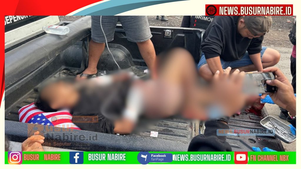 Polisi Jadi Korban Pembacokan Brutal Samurai, Polres Dogiyai Buru Pelaku (Foto: Huams Polres Dogiyai)